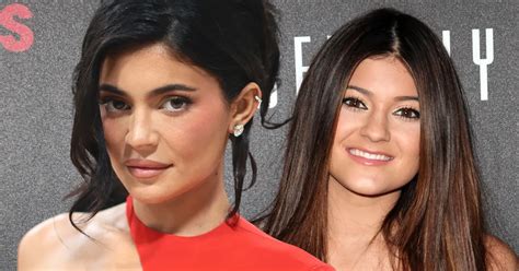 kylie vorher nachher|So anders sah Kylie Jenner vor den ganzen Beauty。